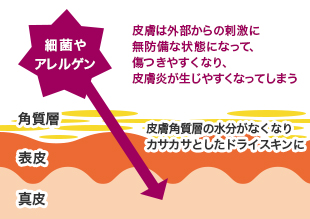 皮膚は外部からの刺激に無防備な状態になって、傷つきやすくなり、皮膚炎が生じやすくなってしまう