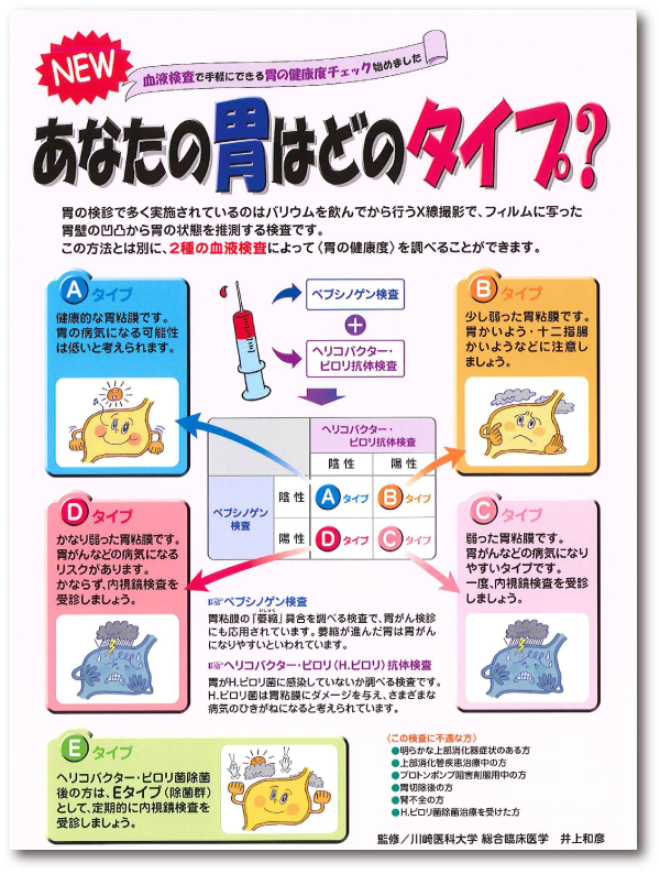 あなたの胃はどのタイプ？