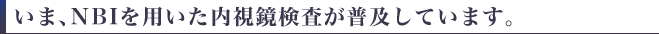 いま、NBIを用いた内視鏡検査が普及しています。